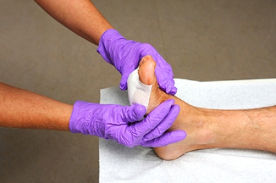 Treatment for Post-Traumatic Wounds of the Foot